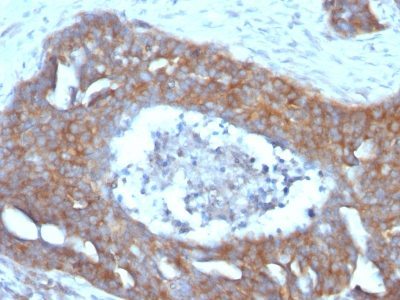 Monoclonal anti pS2 (GE2)