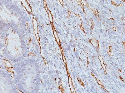Monoclonal anti CD31 / PECAM 1 (JC/70A)