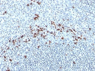 Monoclonal anti Kappa Light Chain (Kap 56)