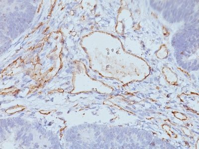 Monoclonal anti CD31 / PECAM 1 (C31.3 + C31.7 + C31.10)