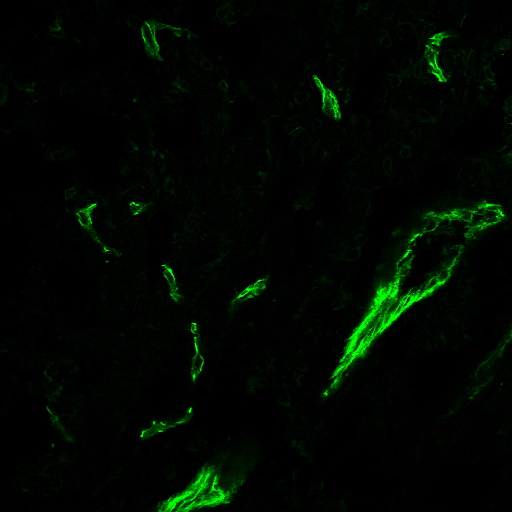 CD31 / PECAM-1 Monoclonal Mouse Antibody (C31.3 + C31.7 + C31.10)