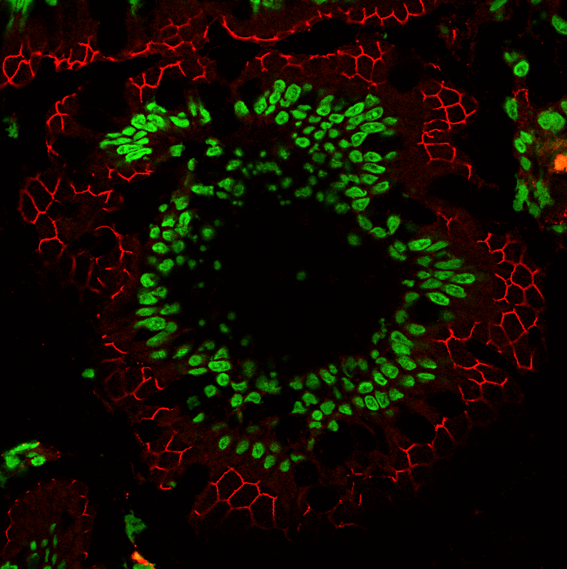 CF555 Mix-n-Stain NucSpot 470 TrueBlack Background Suppressing System Background Suppressor intestine