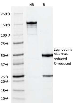 SDS-PAGE Analysis Purified Vimentin Mouse Monoclonal Antibody (VM452).Confirmation of Purity and Integrity of Antibody.