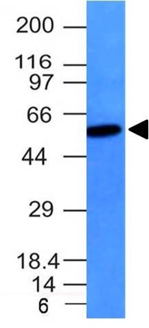 Western Blot Raji Cell Lysate Vimentin Mouse Monoclonal Antibody (VM452).