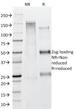 SDS-PAGE Analysis Purified Adipophilin Mouse Monoclonal Antibody (ADFP/1365). Confirmation of Purity and Integrity of Antibody.