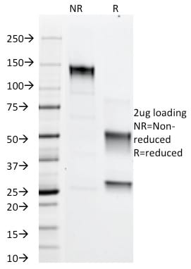 SDS-PAGE Analysis Purified Adipophilin Mouse Monoclonal Antibody (ADFP/1366). Confirmation of Purity and Integrity of Antibody.
