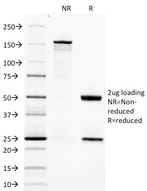 SDS-PAGE Analysis Purified Adiponectin Mouse Monoclonal Antibody (ADPN/1370). Confirmation of Purity and Integrity of Antibody.