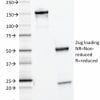 SDS-PAGE Analysis Purified Ferritin Light Chain Mouse Monoclonal Antibody (FTL/1386). Confirmation of Purity and Integrity of Antibody.