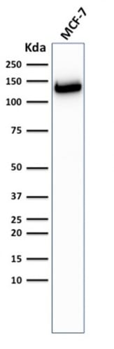 Western Blot Analysis of MCF-7 cells using E-Cadherin Rabbit Recombinant Monoclonal Antibody (CDH1/2208R).
