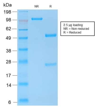 SDS-PAGE Analysis of Purified E-Cadherin Rabbit Recombinant Monoclonal Antibody (CDH1/2208R). Confirmation of Purity and Integrity of Antibody.