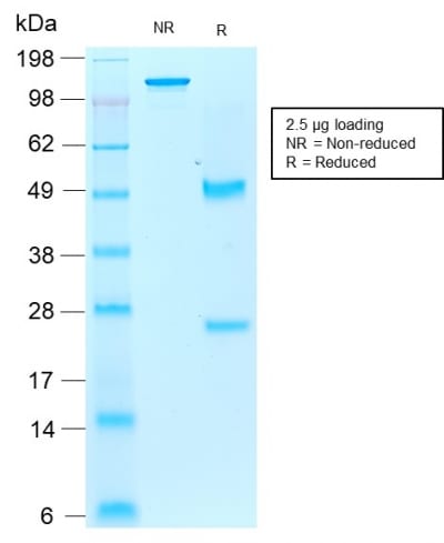 SDS-PAGE Analysis Purified AIF1 / Iba1 Mouse Recombinant Monoclonal Antibody (rAIF1/1909). Confirmation of Purity and Integrity of Antibody.