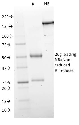 SDS Page Analysis Purified GAD1 (GAD67) Mouse Monoclonal Antibody (GAD1/2563).Confirmation of Purity and Integrity of Antibody.