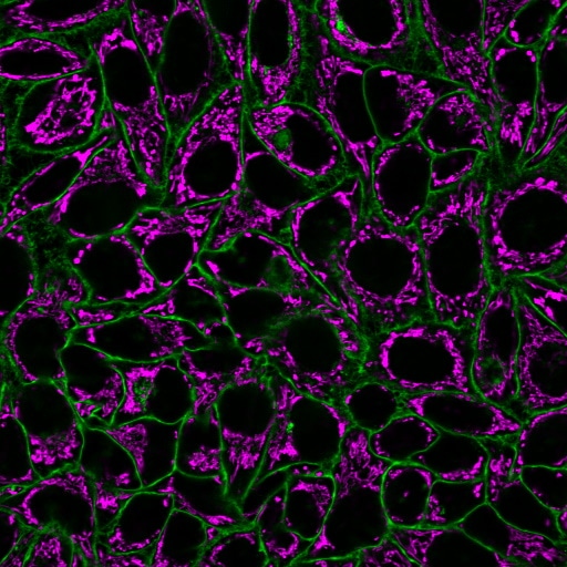 CellBrite® Steady Membrane Staining Kits - Image 9