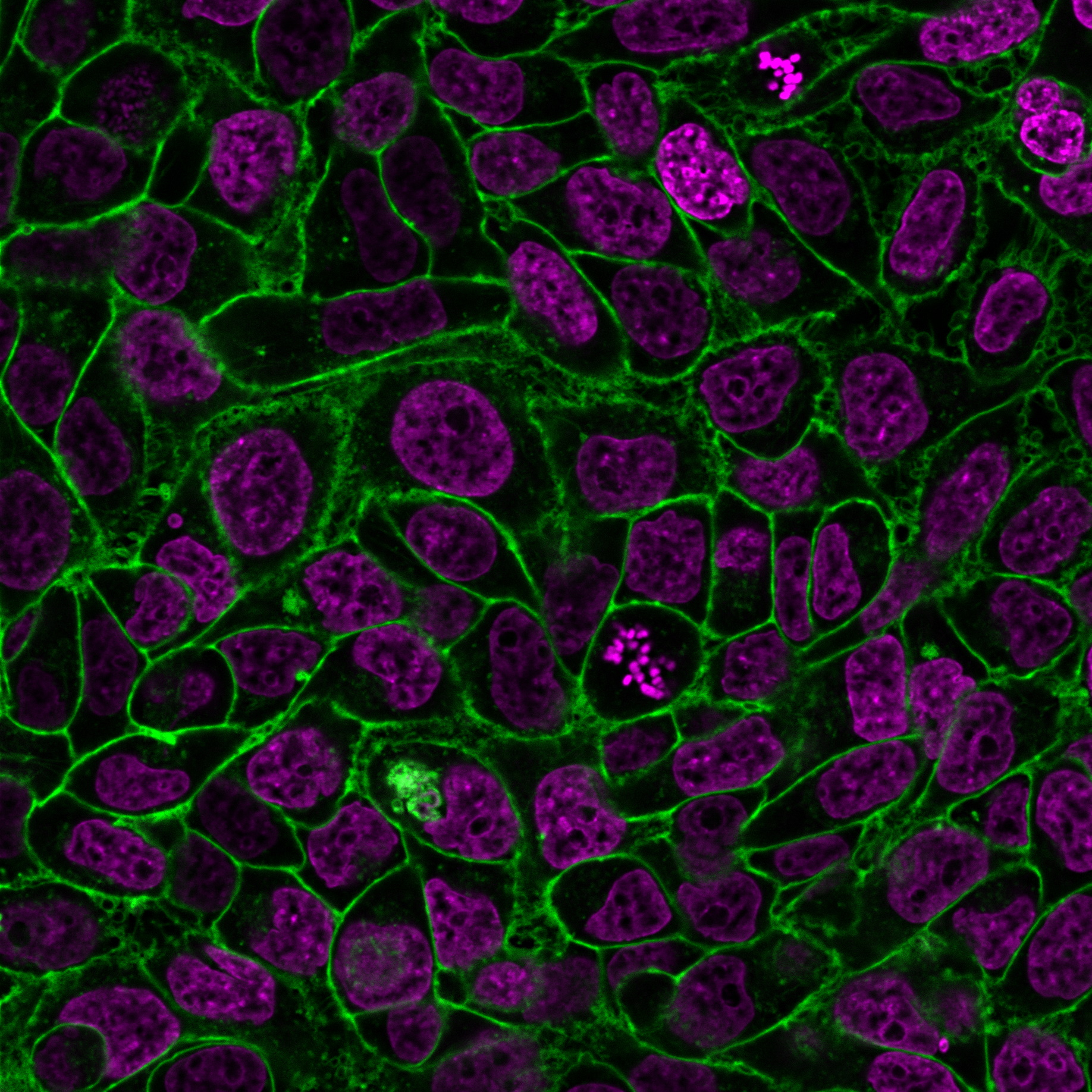 CellBrite® Steady Membrane Staining Kits - Image 4