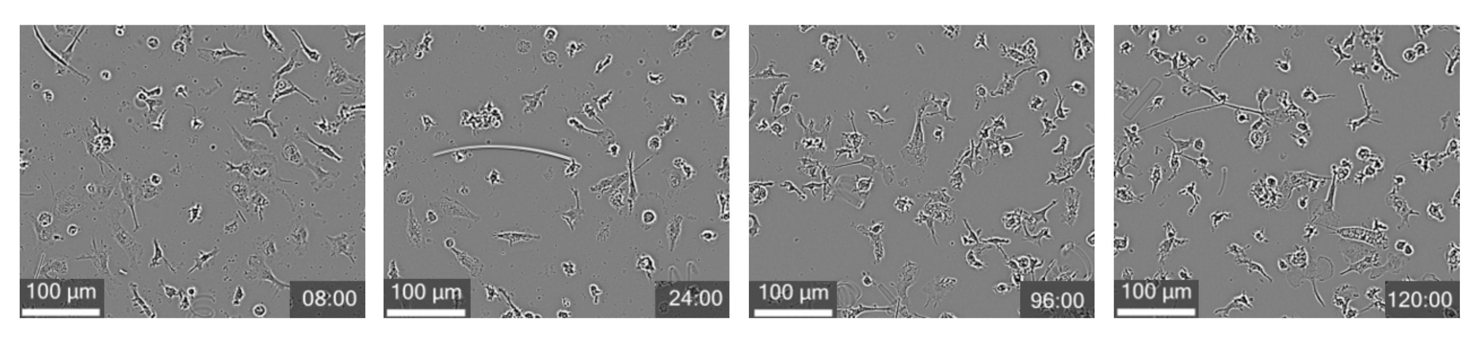 Phase-contrast images showing maturation of BrainXell sensory neurons over time post-thaw