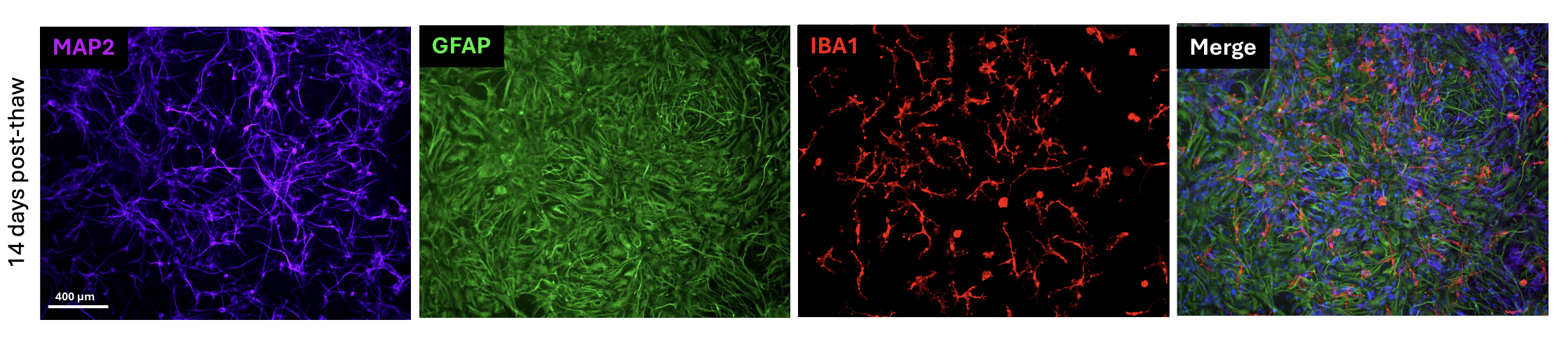 Pharmacological inhibition of NaV1.7 and NaV1.8 in BrainXell sensory neurons