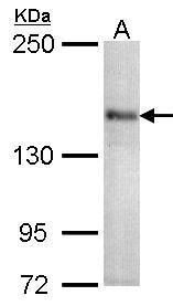 Sample (30 ug of whole cell lysate). A: 293T. 5% SDS PAGE. TA308209 diluted at 1:1000.