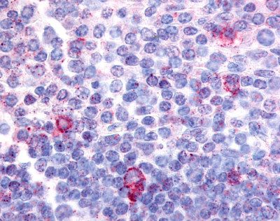 Anti-CNR2 / CB2 antibody IHC of human tonsil, germinal center and mantle zone. Immunohistochemistry of formalin-fixed, paraffin-embedded tissue after heat-induced antigen retrieval.