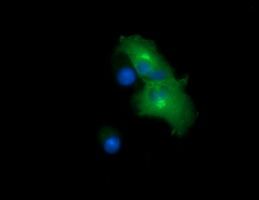 Anti-CHGA mouse monoclonal antibody (TA506098) immunofluorescent staining of COS7 cells transiently transfected by pCMV6-ENTRY CHGA (<a href = "https://www.origene.com/catalog/cdna-clones/expression-plasmids/rc200492-chromogranin-a-chga-nm-001275-human-tagged-orf-clone" title="RC200492" class="">RC200492</a>).