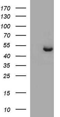 HEK293T cells were transfected with the pCMV6-ENTRY control (Cat# <a href = "https://www.origene.com/catalog/vectors/mammalian-expression-vectors/ps100001-pcmv6-entry-mammalian-expression-vector" title="PS100001" class="">PS100001</a>, Left lane) or pCMV6-ENTRY SPHK1 (Cat# <a href = "https://www.origene.com/catalog/cdna-clones/expression-plasmids/rc203398-sphk1-nm-021972-human-tagged-orf-clone" title="RC203398" class="">RC203398</a>, Right lane) cDNA for 48 hrs and lysed. Equivalent amounts of cell lysates (5 ug per lane) were separated by SDS-PAGE and immunoblotted with anti-SPHK1(Cat# TA507215). Positive lysates <a href = "https://www.origene.com/catalog/proteins/over-expression-lysates/ly411847-sphk1-nm-021972-human-over-expression-lysate" title="LY411847" class="">LY411847</a> (100ug) and <a href = "https://www.origene.com/catalog/proteins/over-expression-lysates/lc411847-sphk1-nm-021972-human-over-expression-lysate" title="LC411847" class="">LC411847</a> (20ug) can be purchased separately from OriGene.