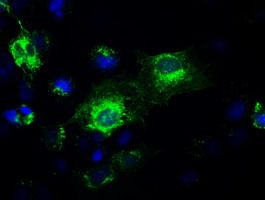 Anti-GAD1 mouse monoclonal antibody (<a href = "https://www.origene.com/catalog/antibodies/primary-antibodies/ta500328-gad67-gad1-mouse-monoclonal-antibody-clone-id-oti3h2" title="TA500328" class="">TA500328</a>) immunofluorescent staining of COS7 cells transiently transfected by pCMV6-ENTRY GAD1 (<a href = "https://www.origene.com/catalog/cdna-clones/expression-plasmids/rc207226-gad67-gad1-nm-000817-human-tagged-orf-clone" title="RC207226" class="">RC207226</a>).