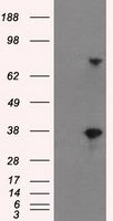 HEK293T cells were transfected with the pCMV6-ENTRY control (Cat# <a href = "https://www.origene.com/catalog/vectors/mammalian-expression-vectors/ps100001-pcmv6-entry-mammalian-expression-vector" title="PS100001" class="">PS100001</a>, Left lane) or pCMV6-ENTRY BTN3A2 (Cat# <a href = "https://www.origene.com/catalog/cdna-clones/expression-plasmids/rc201183-btn3a2-nm-007047-human-tagged-orf-clone" title="RC201183" class="">RC201183</a>, Right lane) cDNA for 48 hrs and lysed. Equivalent amounts of cell lysates (5 ug per lane) were separated by SDS-PAGE and immunoblotted with anti-BTN3A2(Cat# TA500730). Positive lysates <a href = "https://www.origene.com/catalog/proteins/over-expression-lysates/ly402082-btn3a2-nm-007047-human-over-expression-lysate" title="LY402082" class="">LY402082</a> (100ug) and <a href = "https://www.origene.com/catalog/proteins/over-expression-lysates/lc402082-btn3a2-nm-007047-human-over-expression-lysate" title="LC402082" class="">LC402082</a> (20ug) can be purchased separately from OriGene.