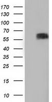 HEK293T cells were transfected with the pCMV6-ENTRY control (Cat# <a href = "https://www.origene.com/catalog/vectors/mammalian-expression-vectors/ps100001-pcmv6-entry-mammalian-expression-vector" title="PS100001" class="">PS100001</a>, Left lane) or pCMV6-ENTRY BTN1A1 (Cat# <a href = "https://www.origene.com/catalog/cdna-clones/expression-plasmids/rc223852-btn1a1-nm-001732-human-tagged-orf-clone" title="RC223852" class="">RC223852</a>, Right lane) cDNA for 48 hrs and lysed. Equivalent amounts of cell lysates (5 ug per lane) were separated by SDS-PAGE and immunoblotted with anti-BTN1A1(Cat# TA501529). Positive lysates <a href = "https://www.origene.com/catalog/proteins/over-expression-lysates/ly400653-btn1a1-nm-001732-human-over-expression-lysate" title="LY400653" class="">LY400653</a> (100ug) and <a href = "https://www.origene.com/catalog/proteins/over-expression-lysates/lc400653-btn1a1-nm-001732-human-over-expression-lysate" title="LC400653" class="">LC400653</a> (20ug) can be purchased separately from OriGene.