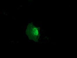 Anti-NSMCE2 mouse monoclonal antibody (<a href = "https://www.origene.com/catalog/antibodies/primary-antibodies/ta501635-nse2-nsmce2-mouse-monoclonal-antibody-clone-id-oti6a6" title="TA501635" class="">TA501635</a>) immunofluorescent staining of COS7 cells transiently transfected by pCMV6-ENTRY NSMCE2 (<a href = "https://www.origene.com/catalog/cdna-clones/expression-plasmids/rc207639-nse2-nsmce2-nm-173685-human-tagged-orf-clone" title="RC207639" class="">RC207639</a>).