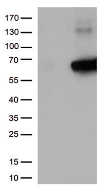 HEK293T cells were transfected with the pCMV6-ENTRY control (Left lane) or pCMV6-ENTRY KEAP1 (<a href = "https://www.origene.com/catalog/cdna-clones/expression-plasmids/rc202189-keap1-nm-203500-human-tagged-orf-clone" title="RC202189" class="">RC202189</a>, Right lane) cDNA for 48 hrs and lysed. Equivalent amounts of cell lysates (5 ug per lane) were separated by SDS-PAGE and immunoblotted with anti-KEAP1 (1:1000).