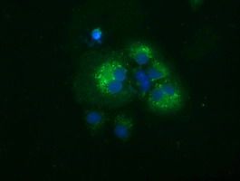 Anti-SQSTM1 mouse monoclonal antibody (TA502127) immunofluorescent staining of COS7 cells transiently transfected by pCMV6-ENTRY SQSTM1 (<a href = "https://www.origene.com/catalog/cdna-clones/expression-plasmids/rc203214-sqstm1-nm-003900-human-tagged-orf-clone" title="RC203214" class="">RC203214</a>).