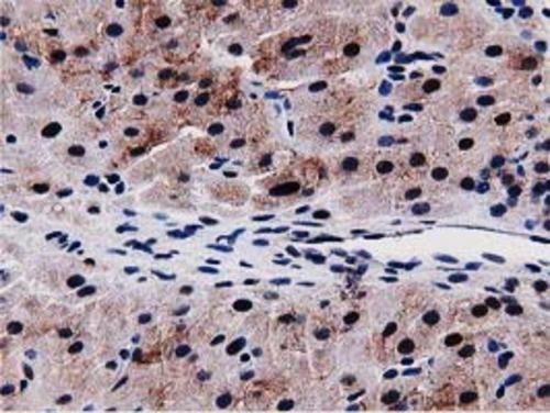Immunohistochemical staining of paraffin-embedded Human Ovary tissue within the normal limits using anti-SQSTM1 mouse monoclonal antibody. Heat-induced epitope retrieval by EDTA solution buffer pH 8.0 at 120°C for 3 min.