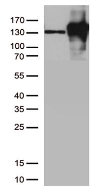 HEK293T cells were transfected with the pCMV6-ENTRY control (Cat# <a href = "https://www.origene.com/catalog/vectors/mammalian-expression-vectors/ps100001-pcmv6-entry-mammalian-expression-vector" title="PS100001" class="">PS100001</a>, Left lane) or pCMV6-ENTRY CDH2 (Cat# <a href = "https://www.origene.com/catalog/cdna-clones/expression-plasmids/rc207170-n-cadherin-cdh2-nm-001792-human-tagged-orf-clone" title="RC207170" class="">RC207170</a>, Right lane) cDNA for 48 hrs and lysed. Equivalent amounts of cell lysates (5 ug per lane) were separated by SDS-PAGE and immunoblotted with anti-CDH2 (Cat# TA503933). Positive lysates <a href = "https://www.origene.com/catalog/proteins/over-expression-lysates/ly419743-n-cadherin-cdh2-nm-001792-human-over-expression-lysate" title="LY419743" class="">LY419743</a> (100ug) and <a href = "https://www.origene.com/catalog/proteins/over-expression-lysates/lc419743-n-cadherin-cdh2-nm-001792-human-over-expression-lysate" title="LC419743" class="">LC419743</a> (20ug) can be purchased separately from OriGene.