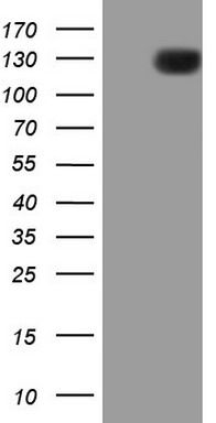 HEK293T cells were transfected with the pCMV6-ENTRY control (Left lane) or pCMV6-ENTRY PDGFRA (<a href = "https://www.origene.com/catalog/cdna-clones/expression-plasmids/rc211740-pdgf-receptor-alpha-pdgfra-nm-006206-human-tagged-orf-clone" title="RC211740" class="">RC211740</a>, Right lane) cDNA for 48 hrs and lysed. Equivalent amounts of cell lysates (5 ug per lane) were separated by SDS-PAGE and immunoblotted with anti-PDGFR. Positive lysates <a href = "https://www.origene.com/catalog/proteins/over-expression-lysates/ly416803-pdgf-receptor-alpha-pdgfra-nm-006206-human-over-expression-lysate" title="LY416803" class="">LY416803</a> (100ug) and <a href = "https://www.origene.com/catalog/proteins/over-expression-lysates/lc416803-pdgf-receptor-alpha-pdgfra-nm-006206-human-over-expression-lysate" title="LC416803" class="">LC416803</a> (20ug) can be purchased separately from OriGene.