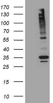 HEK293T cells were transfected with the pCMV6-ENTRY control (Cat# <a href = "https://www.origene.com/catalog/vectors/mammalian-expression-vectors/ps100001-pcmv6-entry-mammalian-expression-vector" title="PS100001" class="">PS100001</a>, Left lane) or pCMV6-ENTRY ABCB1 (Cat# RC216080, Right lane) cDNA for 48 hrs and lysed. Equivalent amounts of cell lysates (5 ug per lane) were separated by SDS-PAGE and immunoblotted with anti-ABCB1 (Cat# TA809796)(1:2000).