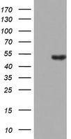 HEK293T cells were transfected with the pCMV6-ENTRY control (Cat# <a href = "https://www.origene.com/catalog/vectors/mammalian-expression-vectors/ps100001-pcmv6-entry-mammalian-expression-vector" title="PS100001" class="">PS100001</a>, Left lane) or pCMV6-ENTRY STK11 (Cat# <a href = "https://www.origene.com/catalog/cdna-clones/expression-plasmids/rc202885-lkb1-stk11-nm-000455-human-tagged-orf-clone" title="RC202885" class="">RC202885</a>, Right lane) cDNA for 48 hrs and lysed. Equivalent amounts of cell lysates (5 ug per lane) were separated by SDS-PAGE and immunoblotted with anti-STK11(Cat# TA802554). Positive lysates <a href = "https://www.origene.com/catalog/proteins/over-expression-lysates/ly424705-lkb1-stk11-nm-000455-human-over-expression-lysate" title="LY424705" class="">LY424705</a> (100ug) and <a href = "https://www.origene.com/catalog/proteins/over-expression-lysates/lc424705-lkb1-stk11-nm-000455-human-over-expression-lysate" title="LC424705" class="">LC424705</a> (20ug) can be purchased separately from OriGene.