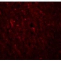 Immunofluorescence of PLEKHM2 in Human Brain cells with PLEKHM2 antibody at 20 ug/mL.
