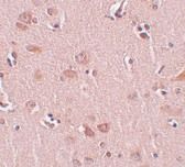Immunohistochemistry of FAM59A in human liver tissue with FAM59A antibody at 5 ug/ml.