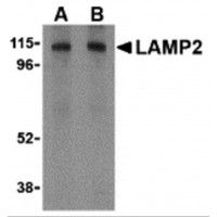 Western blot analysis of LAMP-2 in HepG2 cell lysate with LAMP-2 antibody at (A) 1 and (B) 2ug/ml.