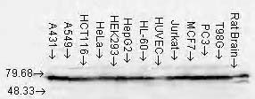 Western Blot analysis of Hsp70/Hsc70 in human cell line lysates at 1:1000 dilution of the antibody