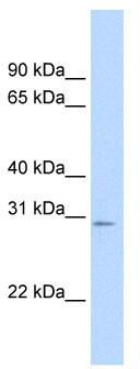 WB Suggested Anti-Tfam Antibody Titration: 0.2-1 ug/ml; Positive Control: SP2/0 cell lysate