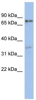 WB Suggested Anti-EOMES Antibody Titration: 0.2-1 ug/ml; ELISA Titer: 1: 1562500; Positive Control: NCI-H226 cell lysate
