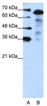WB Suggested Anti-MLXIPL Antibody Titration: 1.25 ug/ml; Positive Control: Jurkat cell lysate