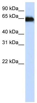 WB Suggested Anti-ADAM12 Antibody Titration: 0.2-1 ug/ml; ELISA Titer: 1: 312500; Positive Control: Human Placenta
