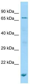 WB Suggested Anti-POF1B Antibody; Titration: 1.0 ug/ml; Positive Control: Jurkat Whole Cell