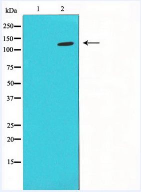 Western blot analysis of extract from HUVEC cells using HIF-1aantibody, The lane on the left is treated with the antigen-specific peptide.