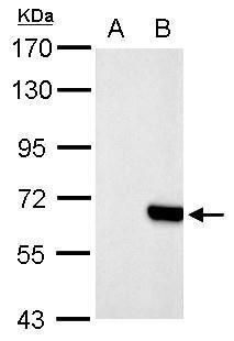 Western blot analysis of extracts from untransfected control cells and transfected cells overexpressing HA-tagged protein (~17 kDa) using HA-tag antibody. A: Non-transfected lysate. B: Transfected lysate.