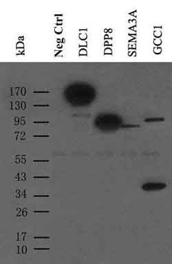 Immunoblot analysis of four different Myc-DDK tagged over-expression lysates and one Empty vector transfected 293T cells with TA150121 at 1:500.