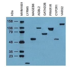 Immunoblot analysis of randomly picked 7 different Myc/DDK tagged overexpression lysates and Myc/DDK tagged Western molecular weight marker (<a href = "https://www.origene.com/catalog/others/molecular-tools/mwm1001-mycddk-tagged-western-blot-molecular-weight-markers" title="MWM1001" class="">MWM1001</a>) with TA50011 at 1:2,000.