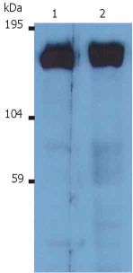 Western Blotting analysis (reducing conditions) of human Sos using anti-Sos (SOS-01). Lane 1: K562 human Caucasian chronic myeloid leukemia cell line;Lane 2: RAJI human Burkitt lymphoma cell line