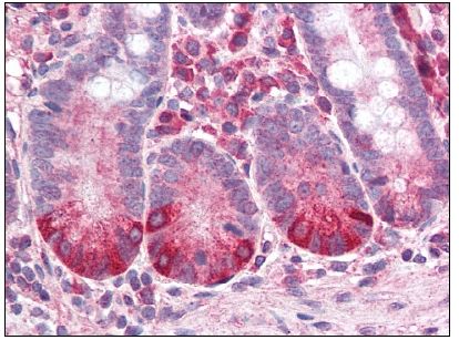 Small Intestine: Formalin-Fixed, Paraffin-Embedded (FFPE)